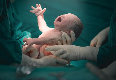 منال عبدالعزيز: ولدت طفلتي بـ 575 غرام فقط ونجاها الله على يد كوادر السلمانية
