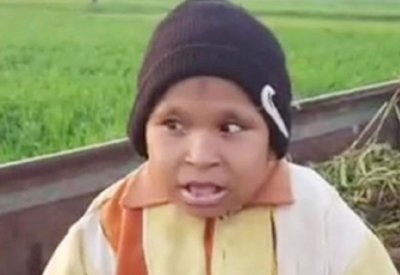 مصري عمره 21 عامًا يعيش على الحليب فقط