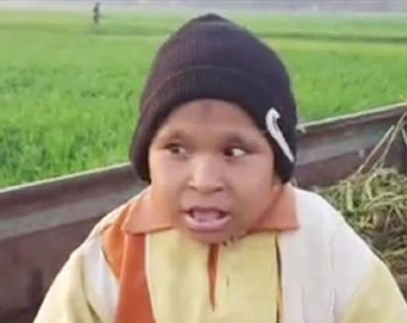مصري عمره 21 عامًا يعيش على الحليب فقط