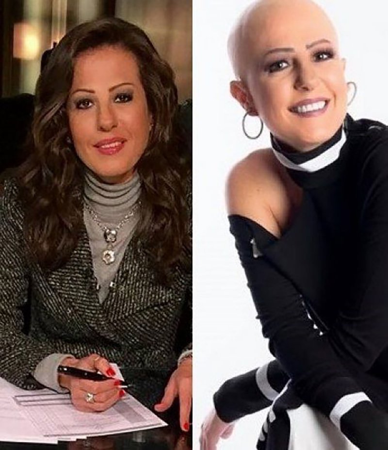 السرطان أسقط شعرها.. مذيعة مصرية تصدم الجمهور