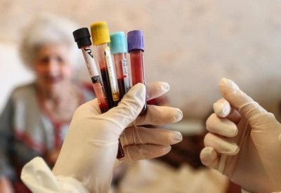 مع مخاوف لقاح أسترازينيكا.. هذه علامات الإصابة بجلطات الدم