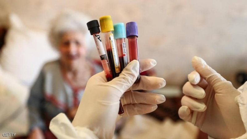 مع مخاوف لقاح أسترازينيكا.. هذه علامات الإصابة بجلطات الدم