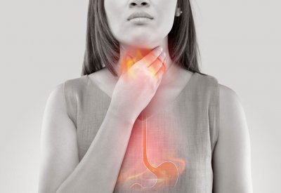كيف تتخلص من حُرقة المعدة