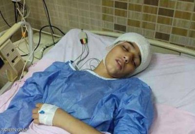 غرس مفتاح في رأس زميله.. كشف ملابسات "جريمة طفل" بمصر