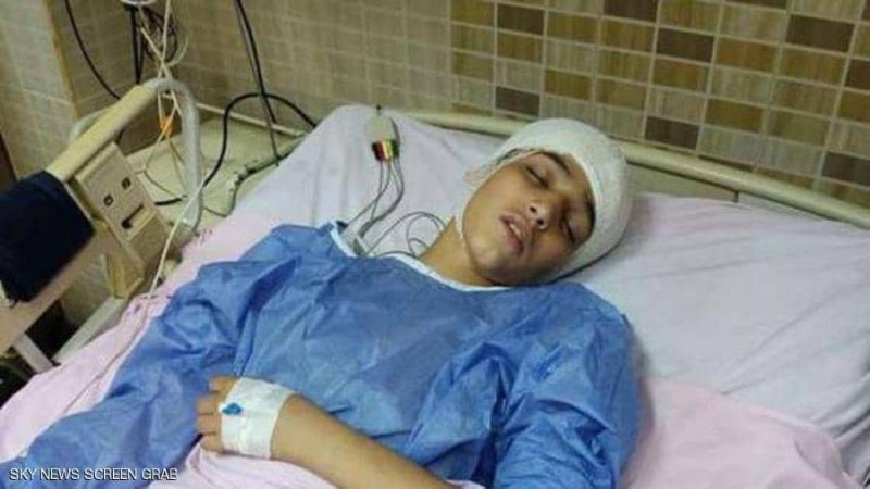 غرس مفتاح في رأس زميله.. كشف ملابسات "جريمة طفل" بمصر