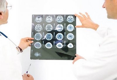 إجراءات لمنع تطور الخرف