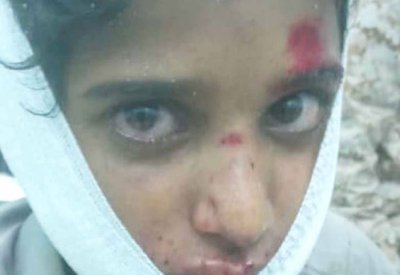 صواريخ باليستية حوثية تحصد ضحايا مدنيين في مأرب