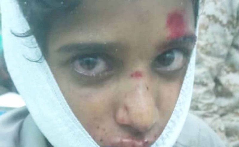 صواريخ باليستية حوثية تحصد ضحايا مدنيين في مأرب