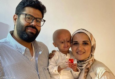 "زين".. طفل مصاب بالشيخوخة يلتحق بالمدرسة ويحلم بالطب