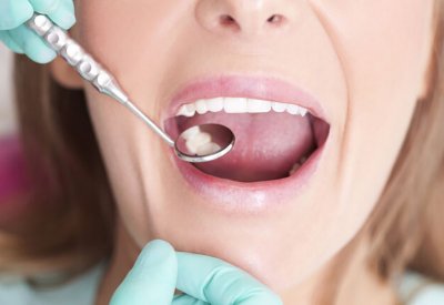 حالات تصيب الفم قد تكون تنبيها على حالة صحية أكثر خطورة