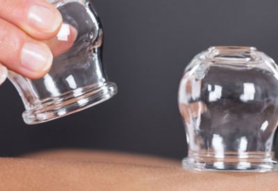 سوق سوداء للحجامة بأسعار لا تتجاوز العشرة دينار