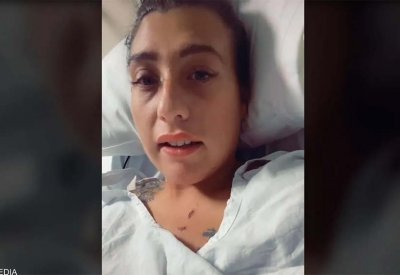 بالصورة: بعد عملية تجميل.. شابة تصاب بعدوى خطيرة نادرة