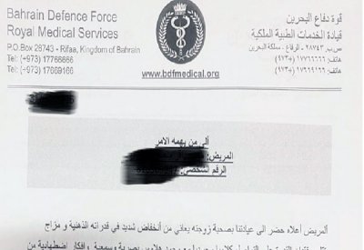 صدمة نفسية بعد السقوط من الحصان.. صرع وهلوسة