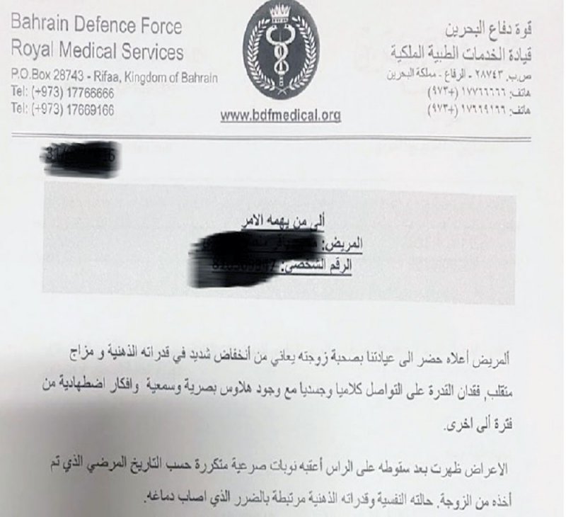 صدمة نفسية بعد السقوط من الحصان.. صرع وهلوسة