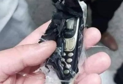 للمرة الثالثة.. استخراج جوال من بطن شاب مصري
