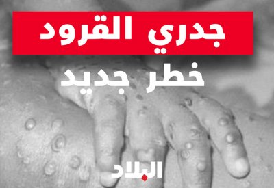فيديو "البلاد": تعرف على جدري القرود ومدى خطورته