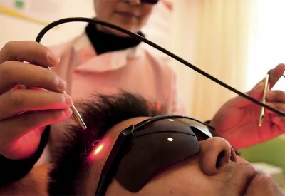الليزر للإقلاع عن التدخين.. تقنية مثيرة للجدل ومكلفة