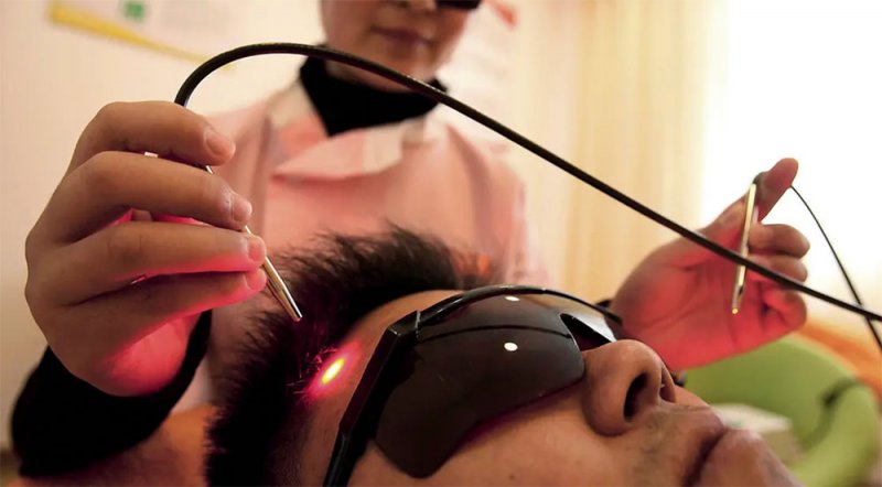 الليزر للإقلاع عن التدخين.. تقنية مثيرة للجدل ومكلفة