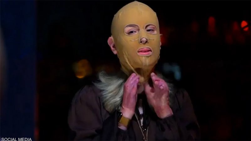 بالفيديو: مصابة بلهيب بركان مدمر تكشف عن وجهها لأول مرة