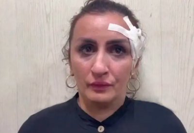 بالصور: أم تبيع رضيعها لإجراء عملية تجميل لأنفها بهذه القيمة