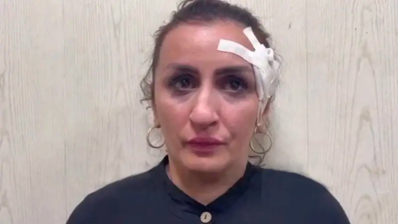 بالصور: أم تبيع رضيعها لإجراء عملية تجميل لأنفها بهذه القيمة