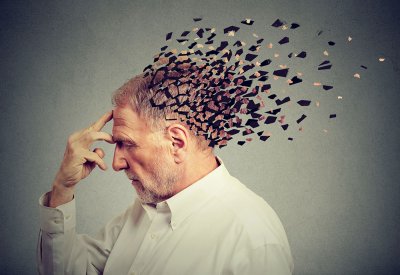 معلومات جديدة عن علاج "ألزهايمر"