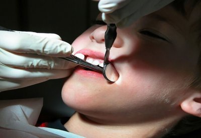 ما أسباب التهاب اللثة وكيفية الوقاية منه؟