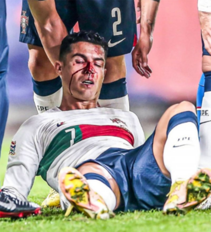 "كسر أنف" رونالدو أمام التشيك