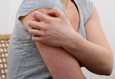 خبيرة تكشف خطورة حساسية البرد