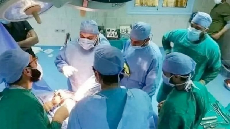 بعد تعافي المتبرعيْن.. كشف تطورات أول حالة زراعة رئة في مصر