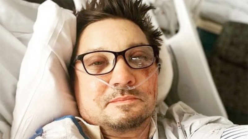 نجم "مارفل" جيريمي رينر ينشر أول صورة بعد الحادث "الغريب"