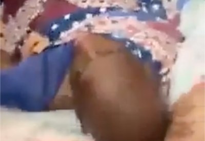بالفيديو: سقوط مصعد بمريض في طريقه لإجراء عملية قلب مفتوح