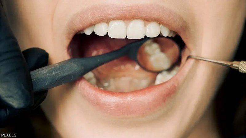 رائحة الفم.. علامة على الإصابة بـ"مرض قاتل"