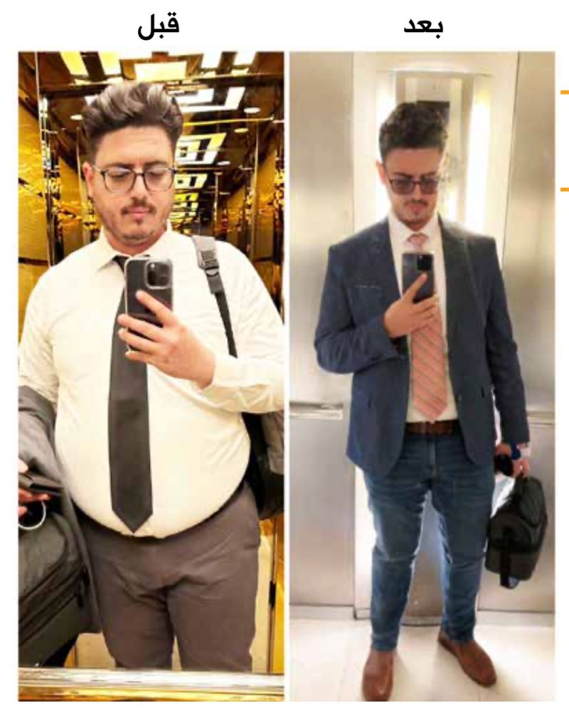 مهند: أضعت أجمل أيام شبابي مع السمنة القاتلة نفسياً وجسدياً