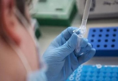 إلغاء الموت: علماء جامعة موسكو يدرسون مادة فريدة مضادة للأكسدة