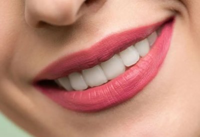 ماذا يحدث إذا لم تنظف الأسنان أسبوعا كاملا؟