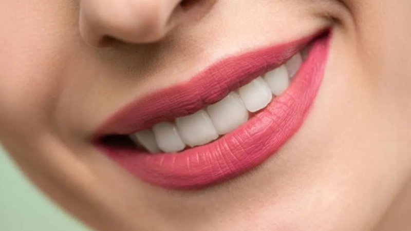 ماذا يحدث إذا لم تنظف الأسنان أسبوعا كاملا؟