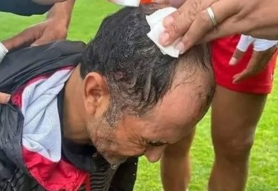 إيقاف مباراة في تونس بعد الاعتداء على مدرب الأفريقي
