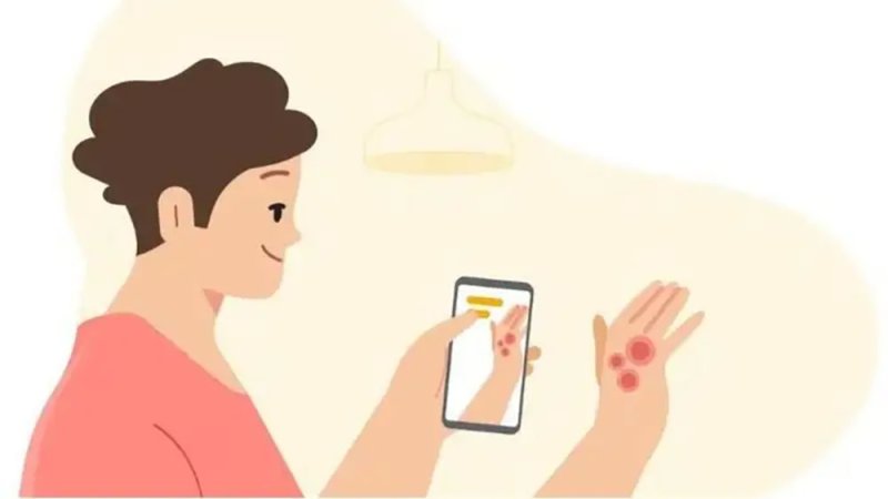 خبر سار من غوغل.. أداة تساعدك بتشخيص الأمراض الجلدية