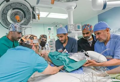 إحسان وبسام.. نجاح فصل التوأم السيامي السوري بالسعودية