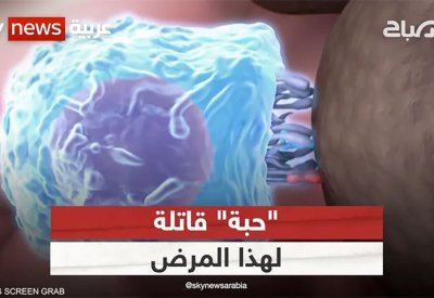 ثورة في علاج المرض الخبيث.. تطوير حبة قاتلة للسرطان