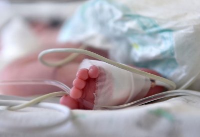 إخلاء رضيع سعودي 1000 كم لإنقاذه من ضيق تنفسي حاد