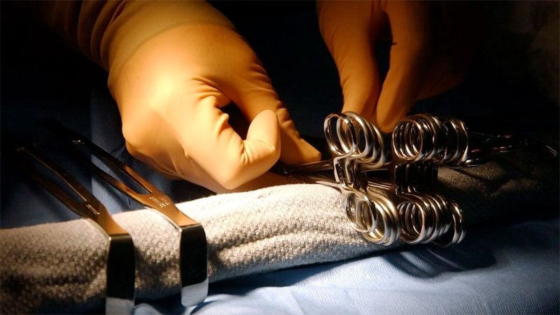 ضبط عصابة "دكتور فؤاد".. ميكانيكي يخدر الضحايا ويسرق الكلى
