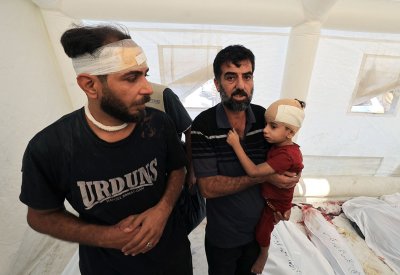منظمة الصحة: عمليات جراحية تجرى بدون تخدير في غزة
