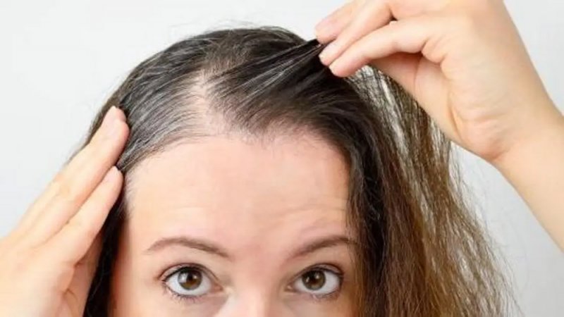 للوقاية من الشيب المبكر.. استوصوا بهذه الأطعمة الخارقة