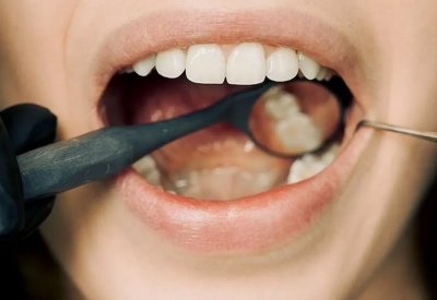 رائحة الفم الكريهة.. سبب تجهله وراء ذلك