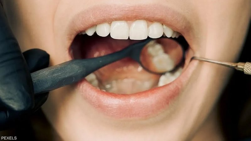 رائحة الفم الكريهة.. سبب تجهله وراء ذلك