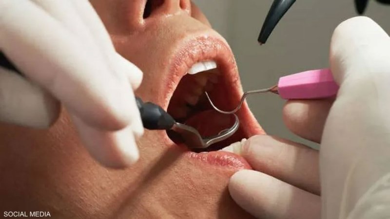 عامل نظافة ينتحل صفة طبيب.. والمريض دفع الثمن من أسنانه