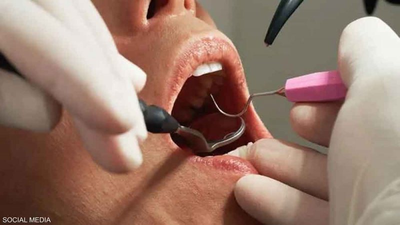 عامل نظافة ينتحل صفة طبيب.. والمريض دفع الثمن من أسنانه