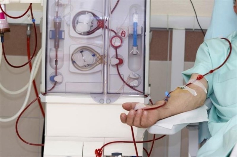تشغيل مركز “عبدالله بن خالد” لمرضى الكلى قريبًا
